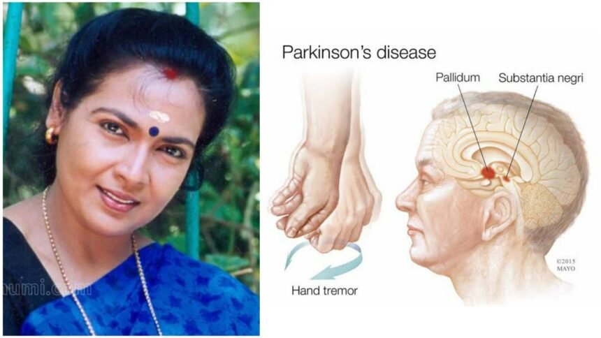 There is no cure for this disease – What caused the death of actress Kanakalatha with Parkinson's disease?  Read in detail